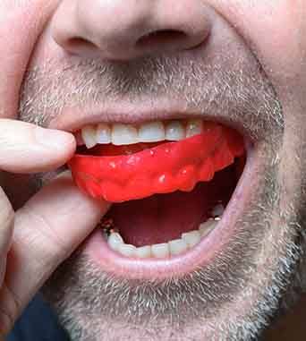 Close-up of man putting mouthguard over teeth
